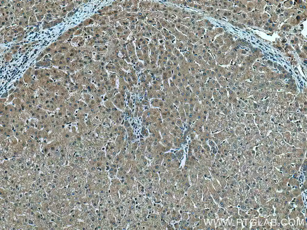 Immunohistochemical (IHC) analysis of paraffin-embedded human liver tissue slide using 20886-1-AP (AIFM2/ FSP1 antibody) at dilution of 1:200 (under 10x lens).
