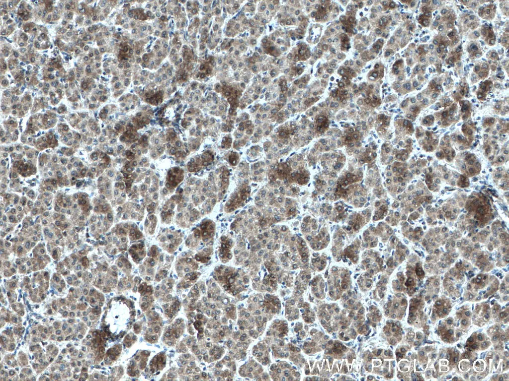 AKR7A2 antibody (66677-1-Ig) | Proteintech