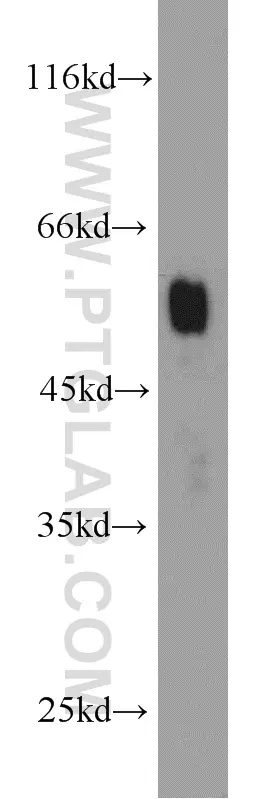 Amylase Alpha antibody (15845-1-AP) | Proteintech