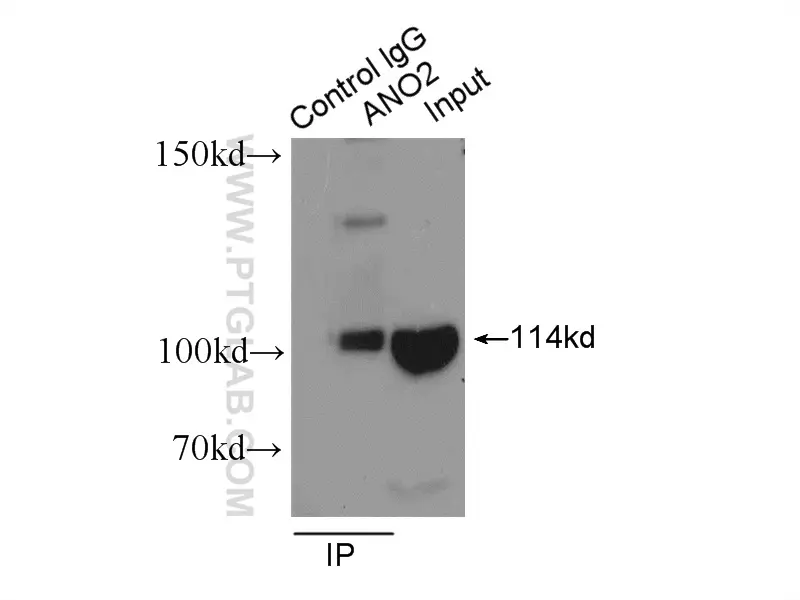 ANO2 antibody (20647-1-AP) | Proteintech