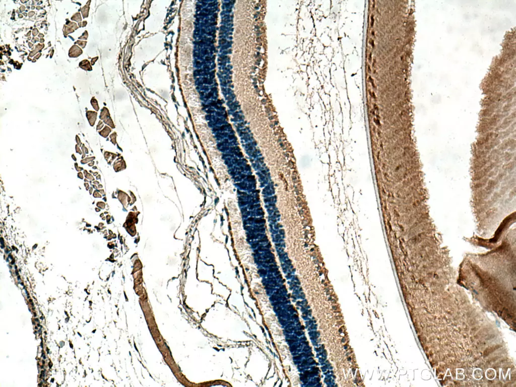 ANO2 antibody (67638-1-Ig) | Proteintech