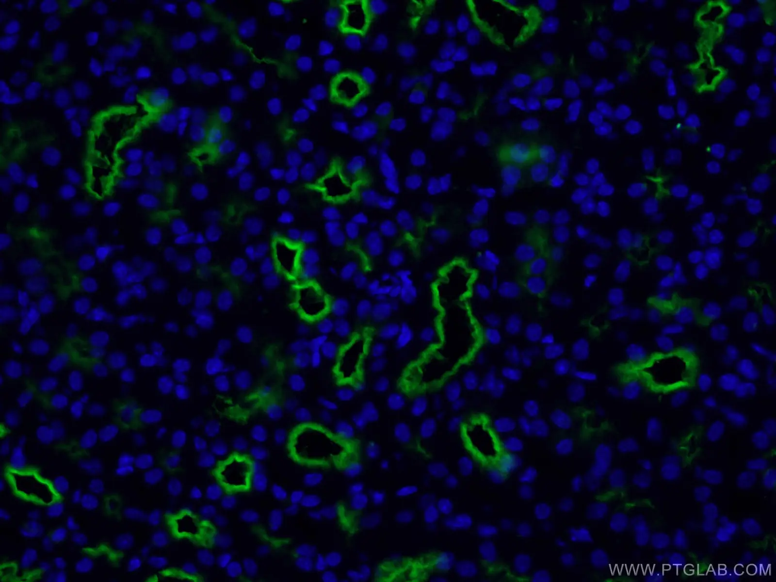 CD13 antibody (66211-1-Ig) | Proteintech