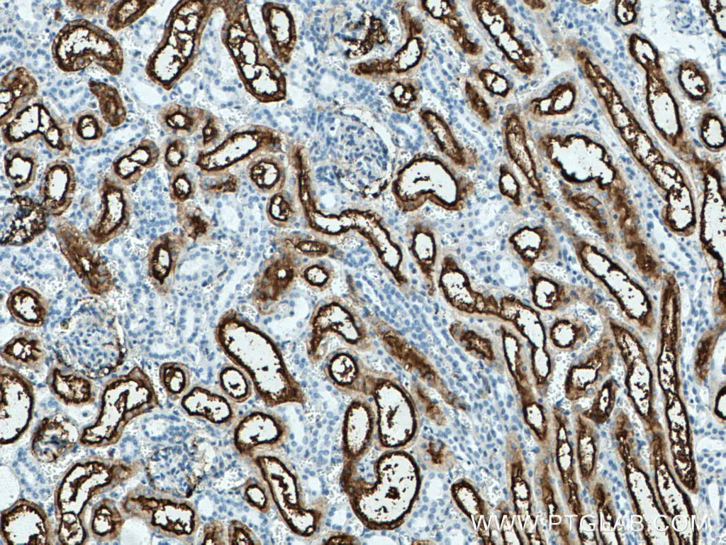 CD13 antibody (66211-1-Ig) | Proteintech