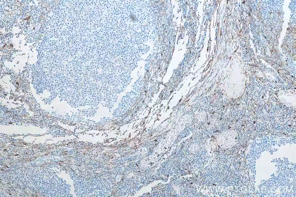 IHC of human tonsilitis tissue stained with proteintech's CD13 antibody 66211-1-IG