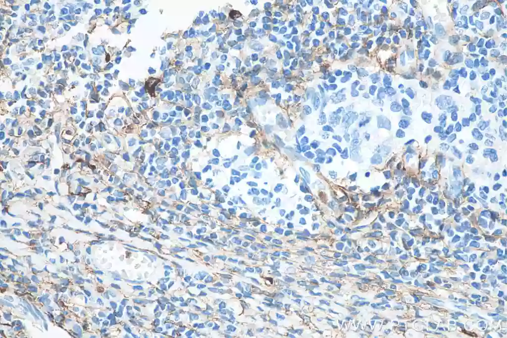 CD13 antibody (66211-1-Ig) | Proteintech