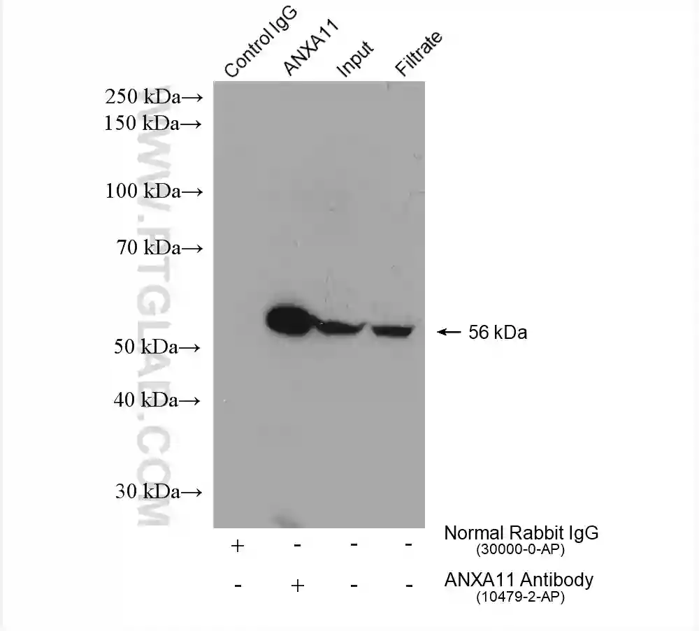 Annexin A11 antibody (10479-2-AP) | Proteintech