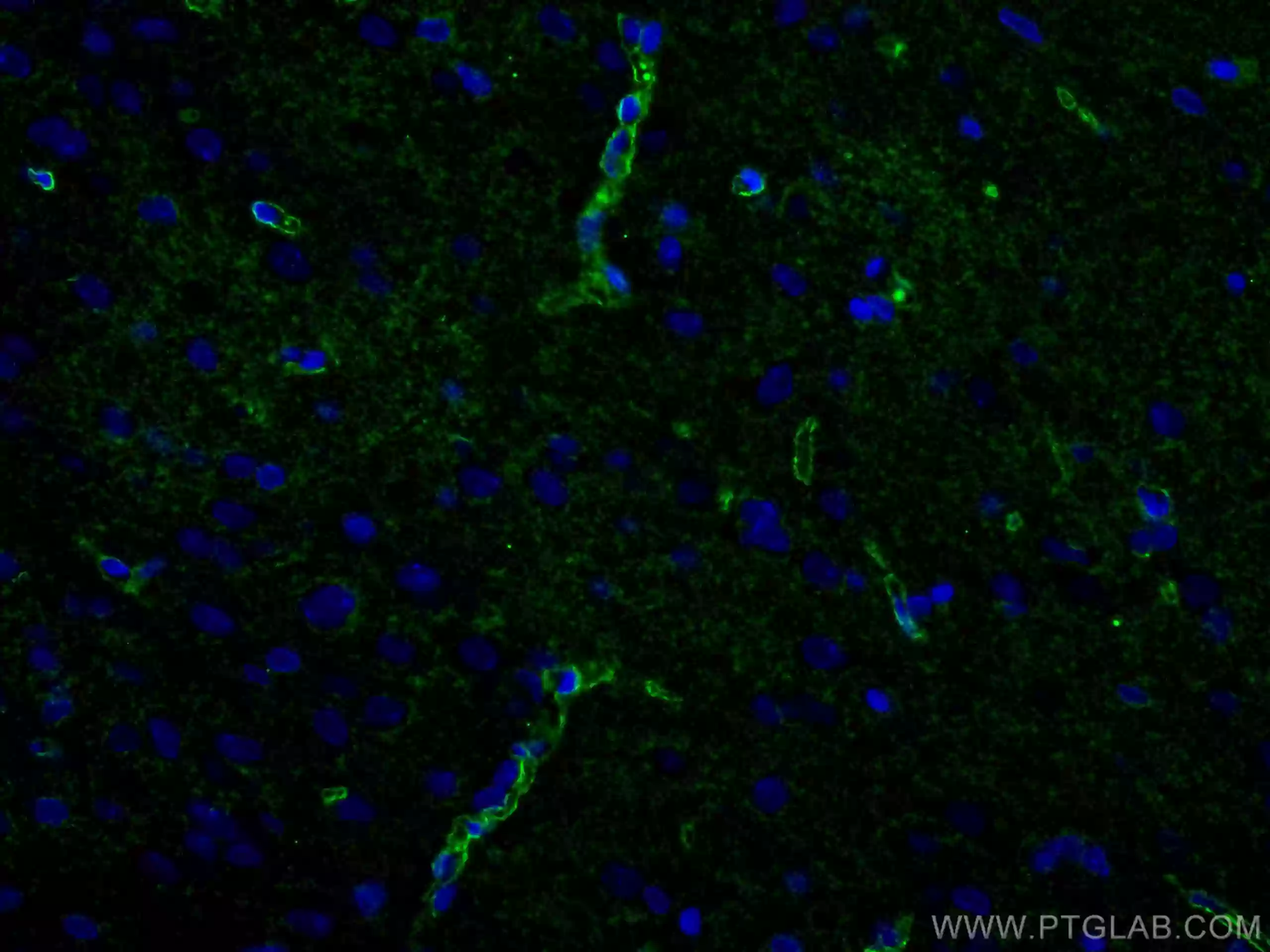 IF (immunofluorescence) analysis of rat brain with aquaporin 4 polyclonal antibody