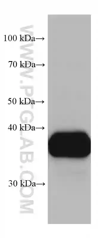 Arginase-1 antibody (66129-1-Ig) | Proteintech