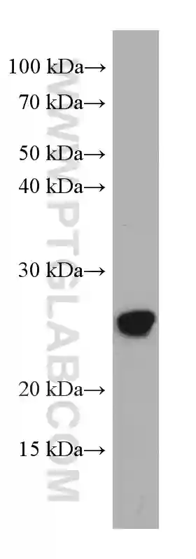 ASC TMS1 antibody 67494 1 Ig Proteintech