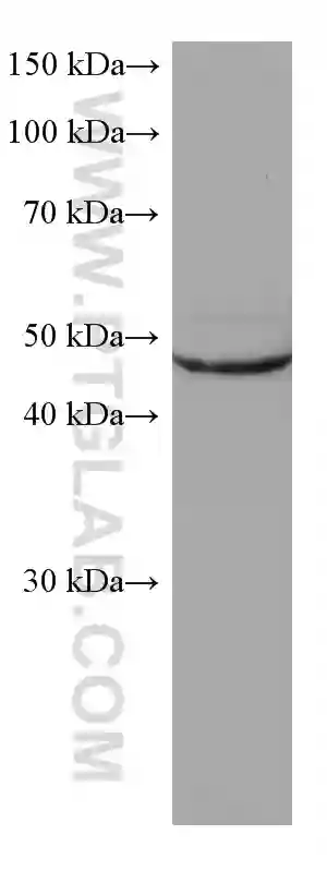 ASL antibody (67692-1-Ig) | Proteintech