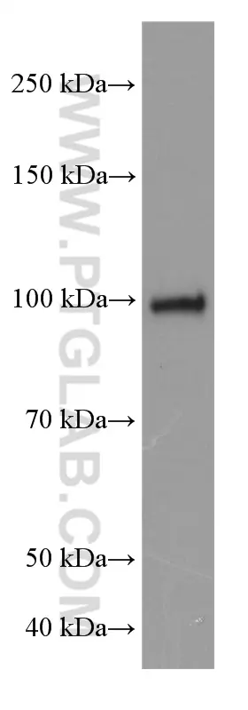 ATF6 antibody (66563-1-Ig) | Proteintech