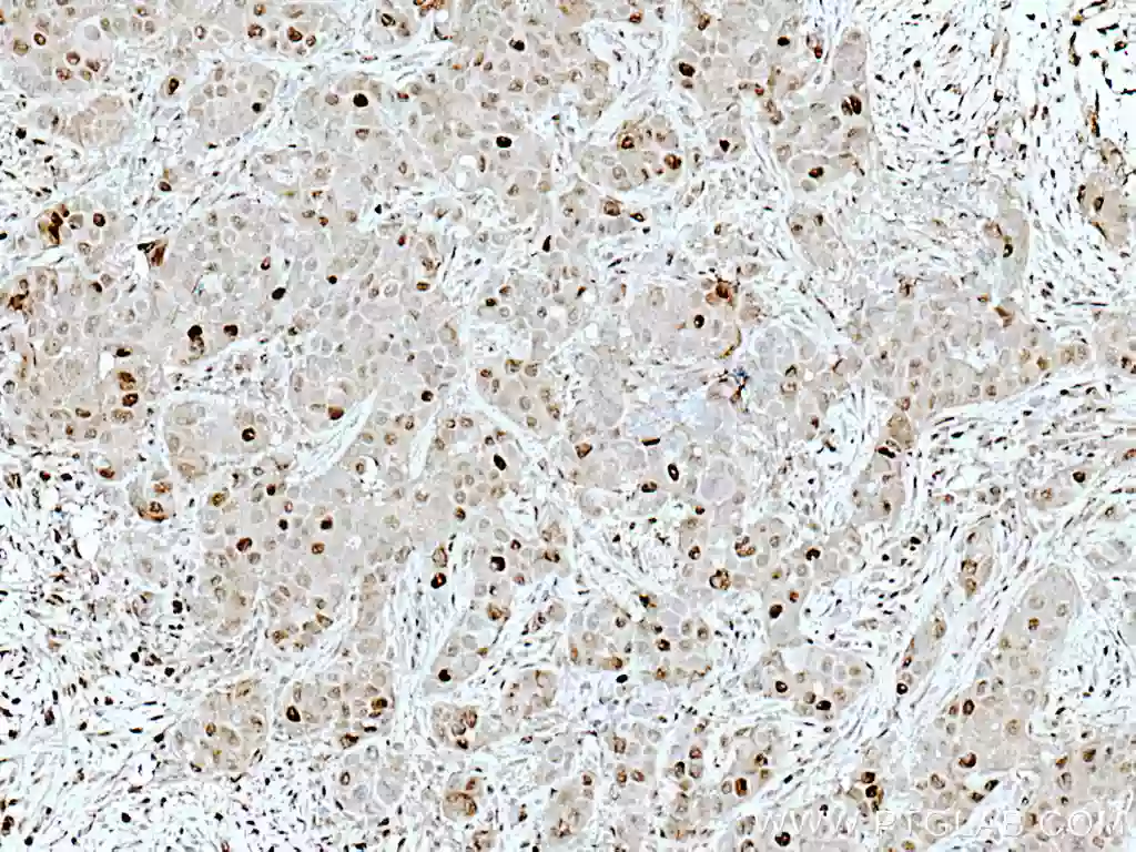 ATM antibody (27156-1-AP) | Proteintech