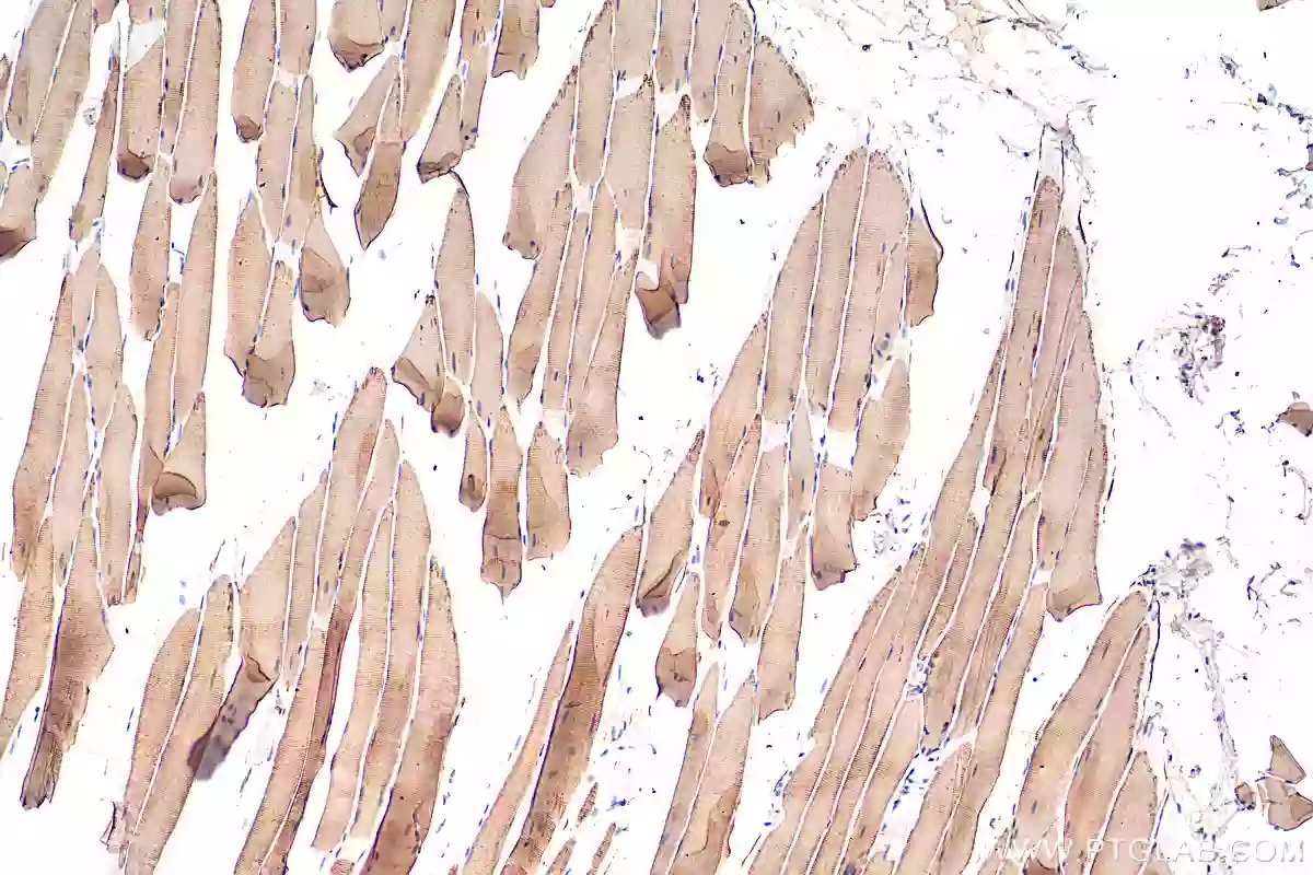 ATP2A1 antibody (22361-1-AP) | Proteintech