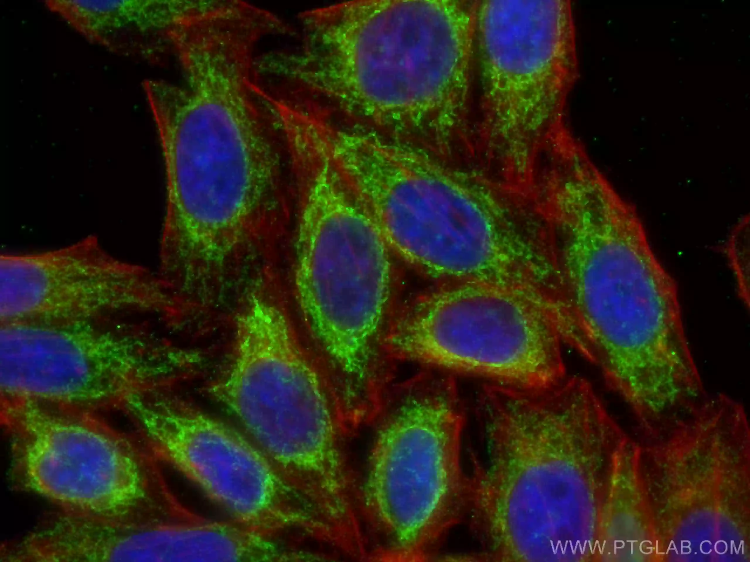 ATP5A1 antibody (82288-1-RR) | Proteintech