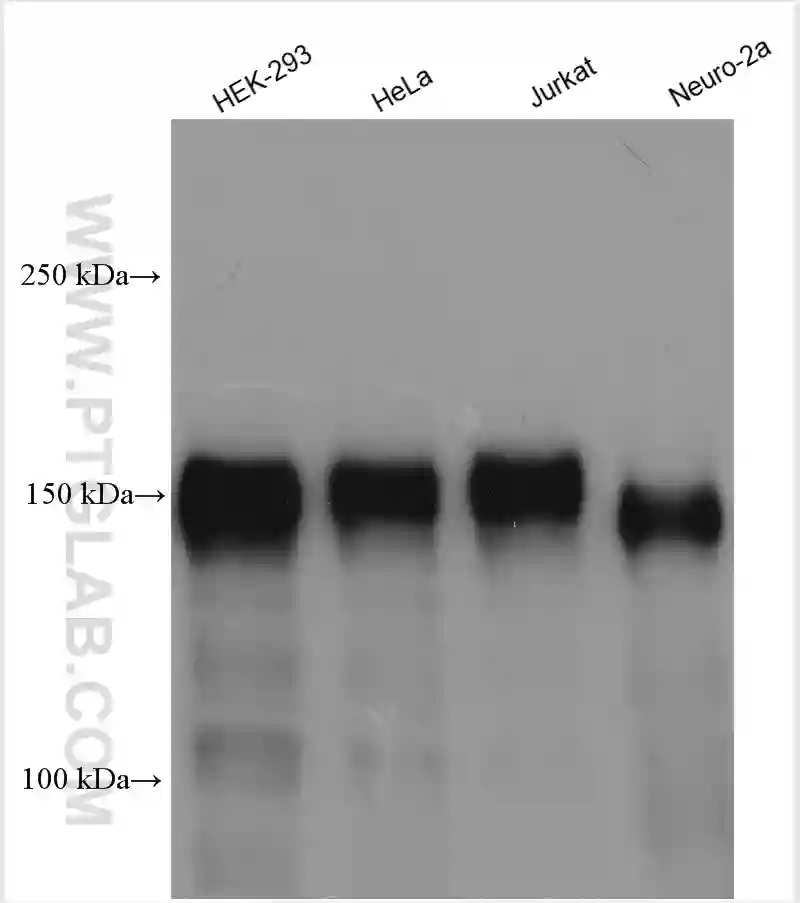 Ataxin 2 antibody (21776-1-AP) | Proteintech