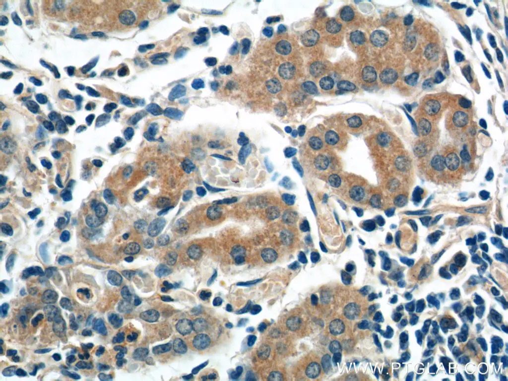 AZI2/NAP1 antibody (15042-1-AP) | Proteintech