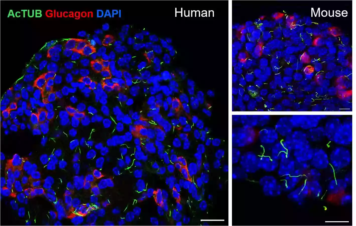 acetylated Tubulin(Lys40) antibody (66200-1-Ig) | Proteintech