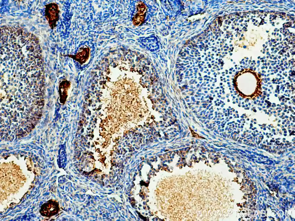 acetylated Tubulin(Lys40) antibody (66200-1-Ig) | Proteintech