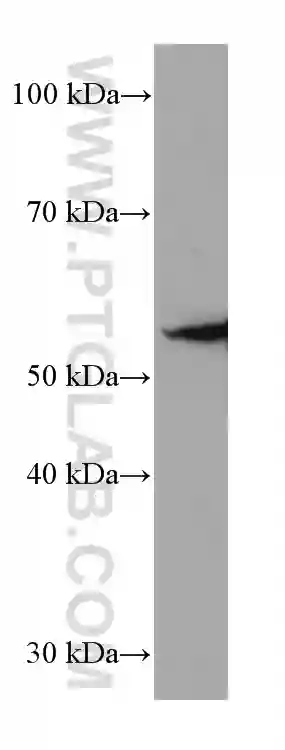 acetylated Tubulin(Lys40) antibody (66200-1-Ig) | Proteintech