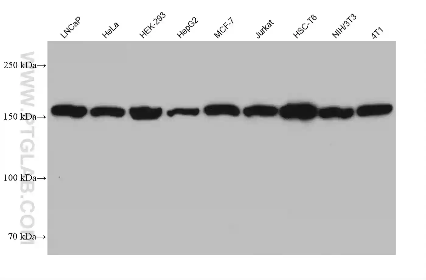 Ataxin 2 antibody (68316-1-Ig) | Proteintech