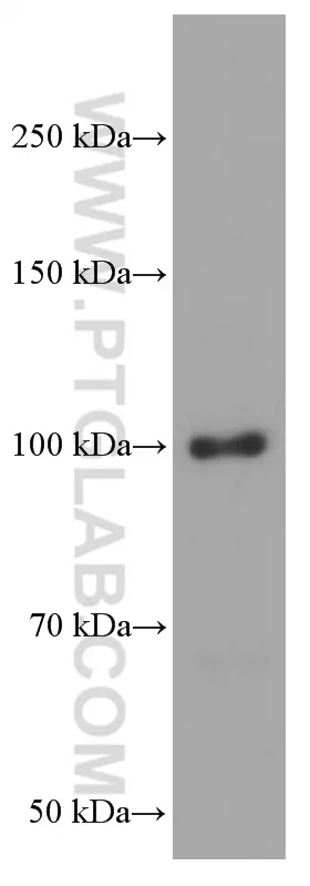 BACH1 antibody (66762-1-Ig) | Proteintech