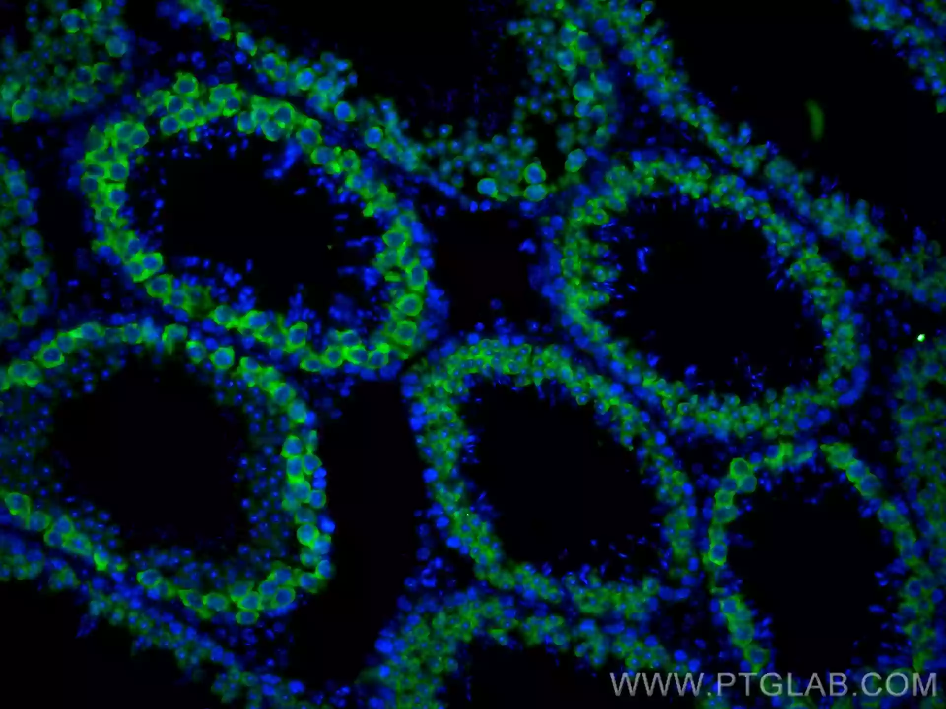 BOULE antibody (CL488-13720) | Proteintech