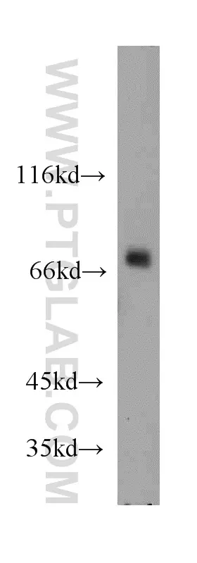 BRD7 antibody (51009-2-AP) | Proteintech