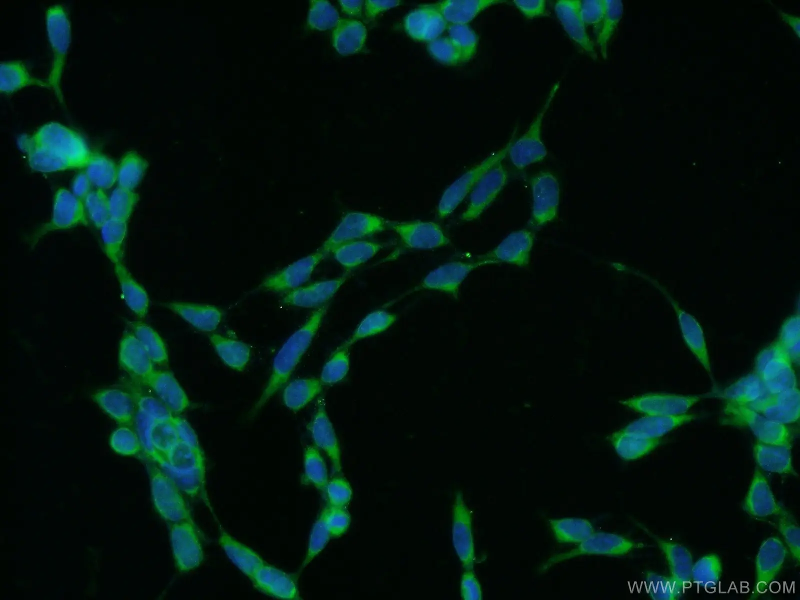 C16orf84 antibody (23337-1-AP) | Proteintech