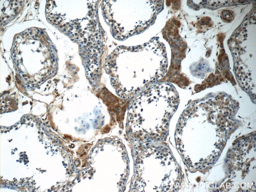 C16orf84 antibody (23337-1-AP) | Proteintech