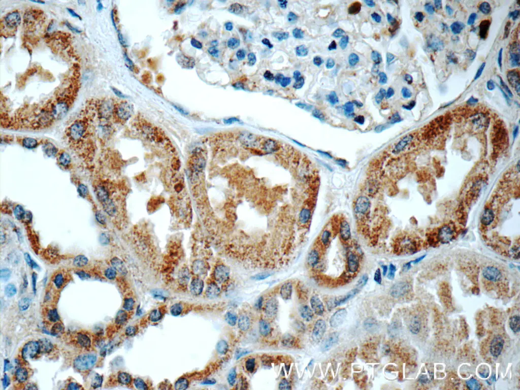 C16orf84 antibody (23337-1-AP) | Proteintech