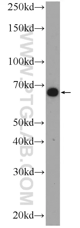 C16orf84 antibody (23337-1-AP) | Proteintech