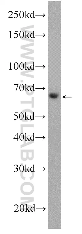 C16orf84 antibody (23337-1-AP) | Proteintech