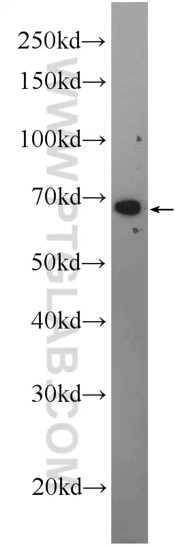 C16orf84 antibody (23337-1-AP) | Proteintech