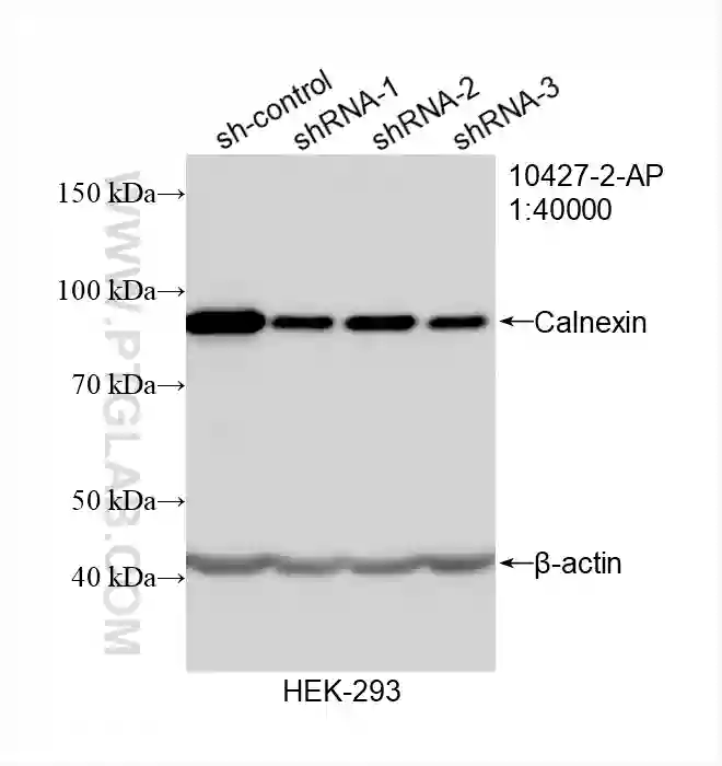 Calnexin antibody (10427-2-AP) | Proteintech