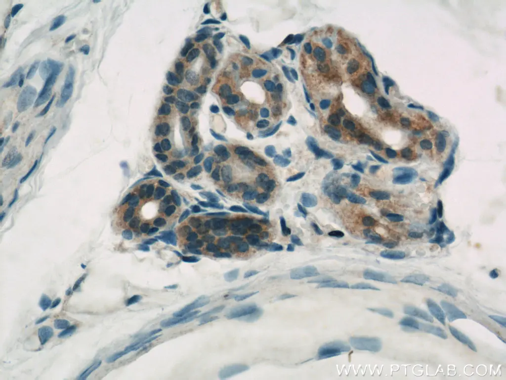 Immunohistochemistry of paraffin-embedded human skin using CASP6 antibody