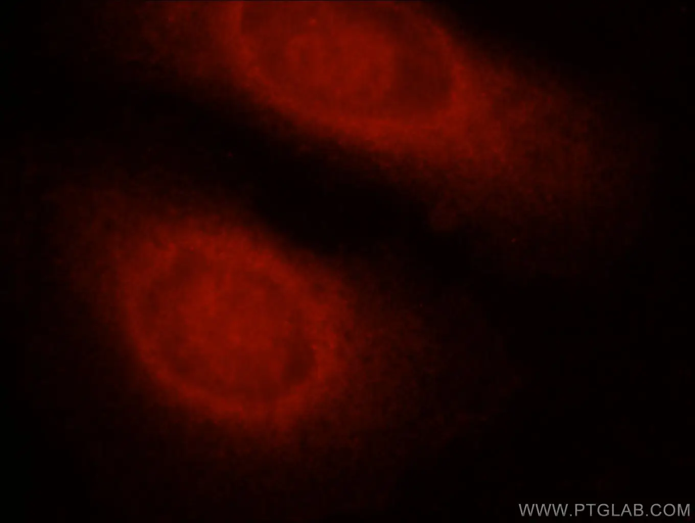 Immunofluorescent analysis of HepG2 cells using Caspase 8 antibody