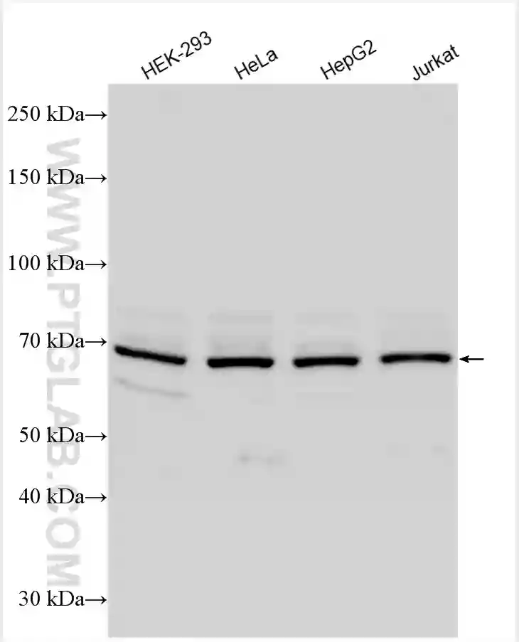 CCDC22 antibody (16636-1-AP) | Proteintech
