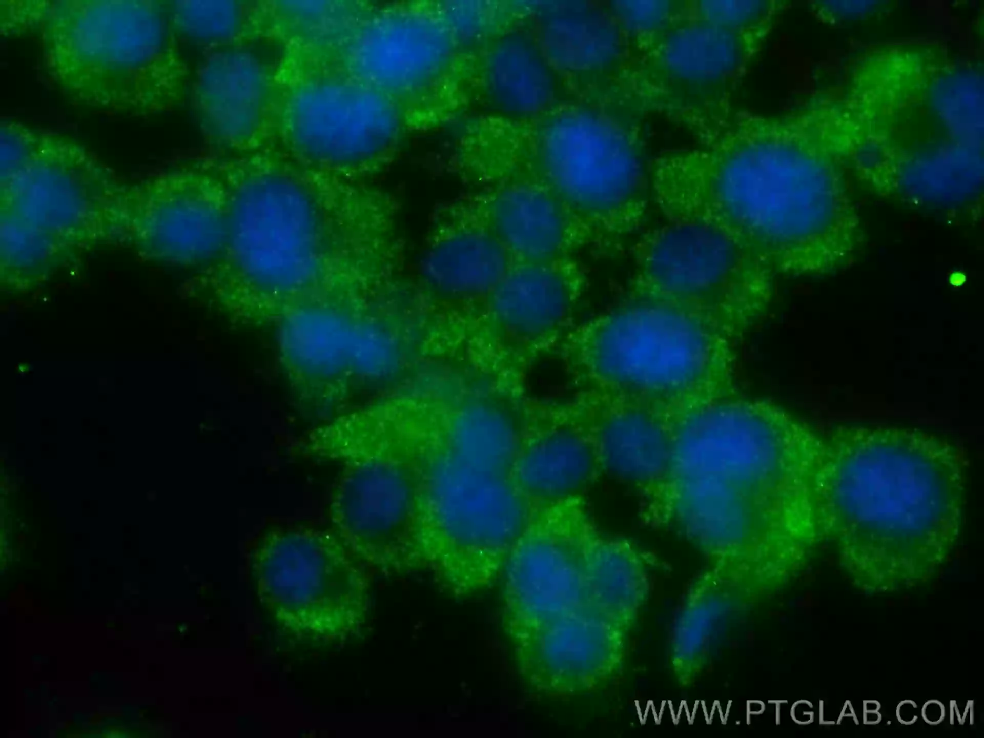 Cyclin B2 antibody (67726-1-Ig) | Proteintech