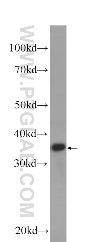 Cyclin D1 antibody (60186-1-Ig) | Proteintech