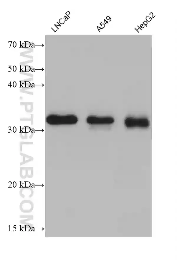 CCS antibody (68341-1-Ig) | Proteintech