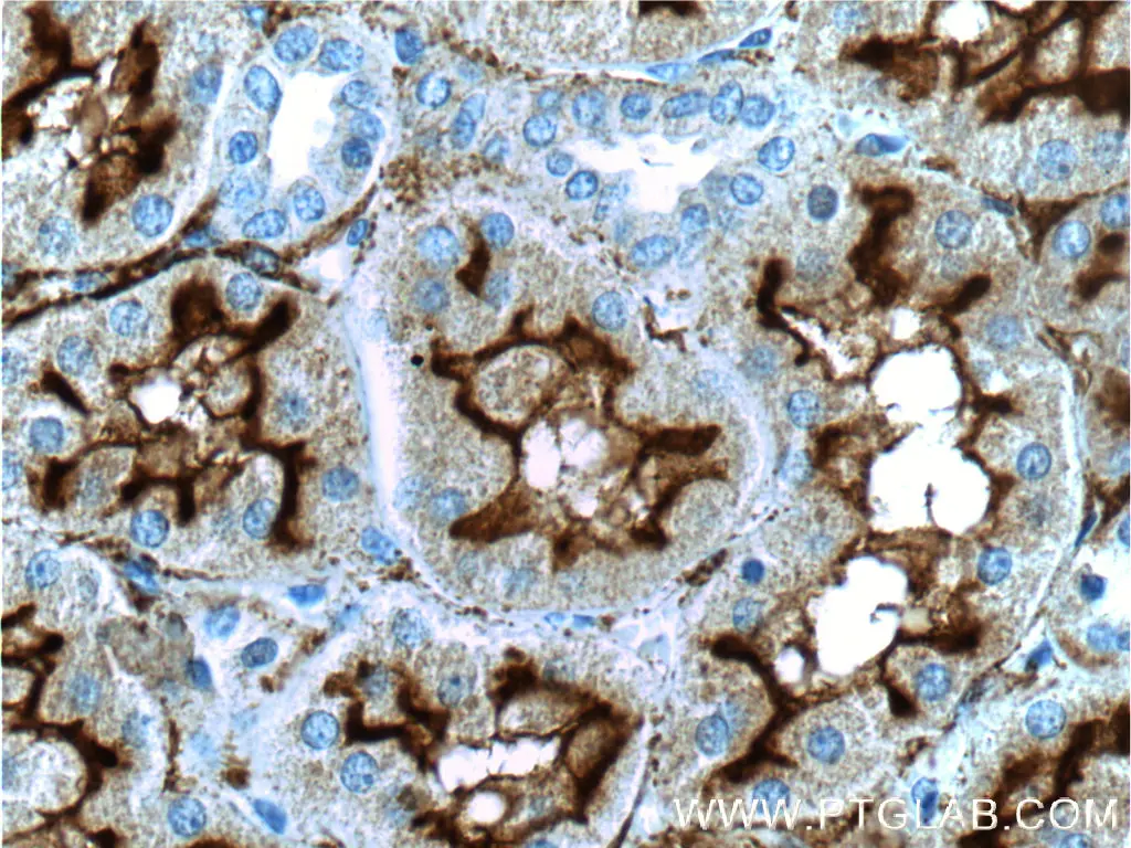 MME,CD10 antibody (23782-1-AP) | Proteintech