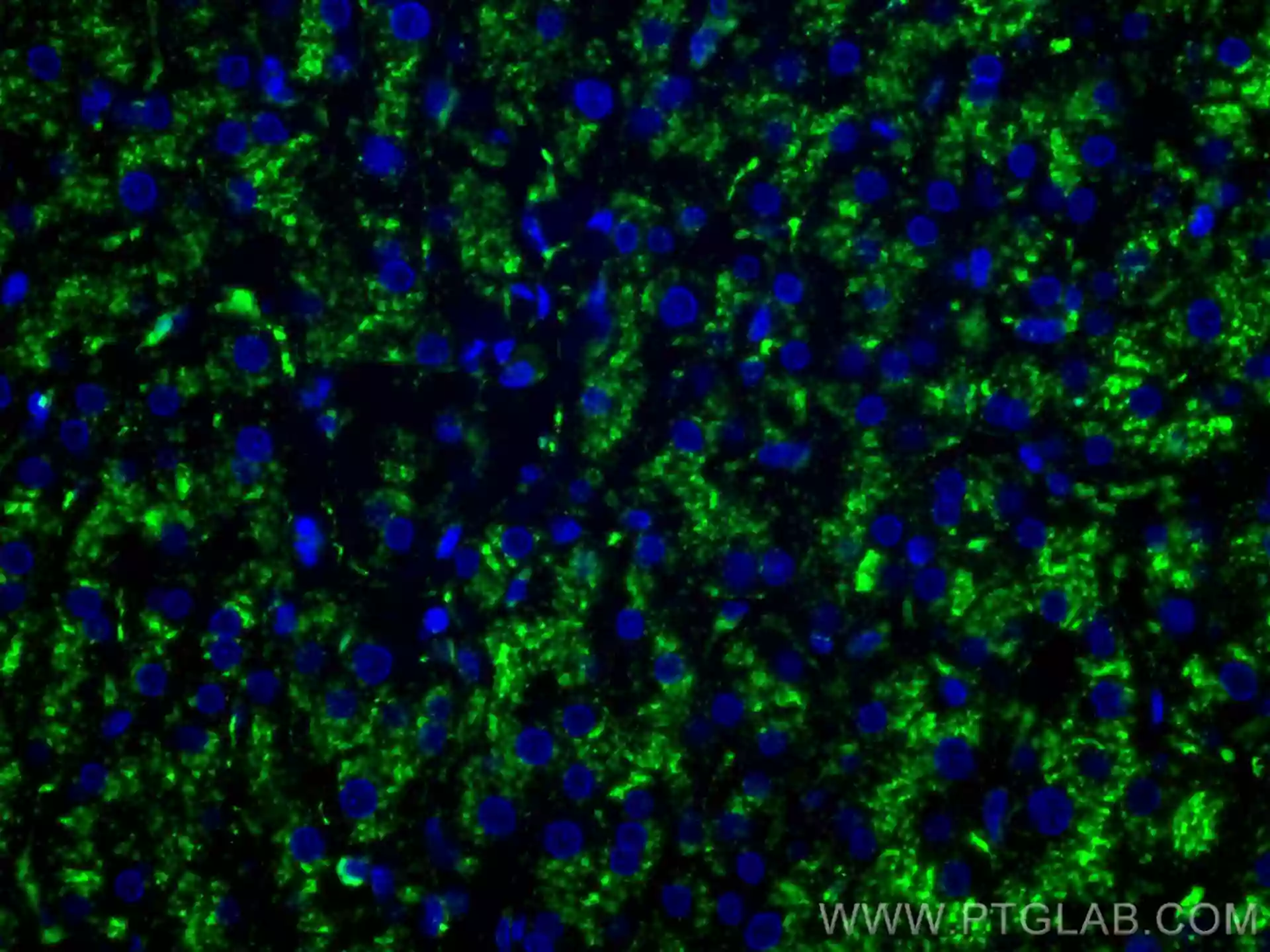 CD107a / LAMP1 antibody (CL488-67300) | Proteintech