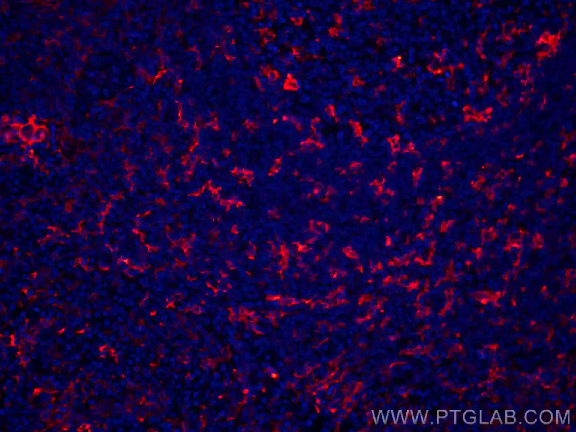 CD11c/Integrin Alpha X antibody (CL594-60258) | Proteintech