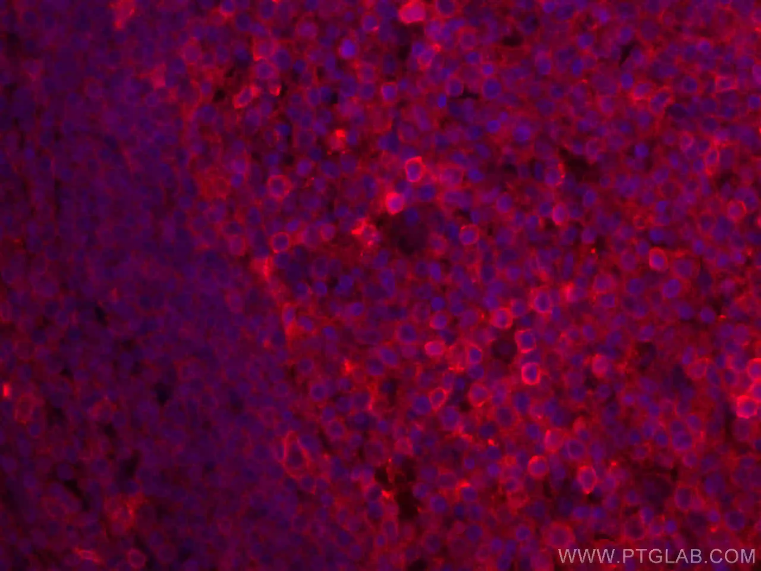 CD147 antibody (66443-1-Ig) | Proteintech