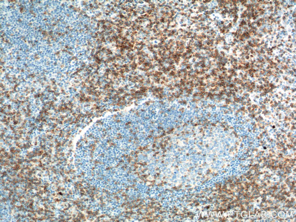 CD2 antibody (10299-1-AP) | Proteintech