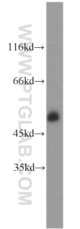 CD2 antibody (10299-1-AP) | Proteintech
