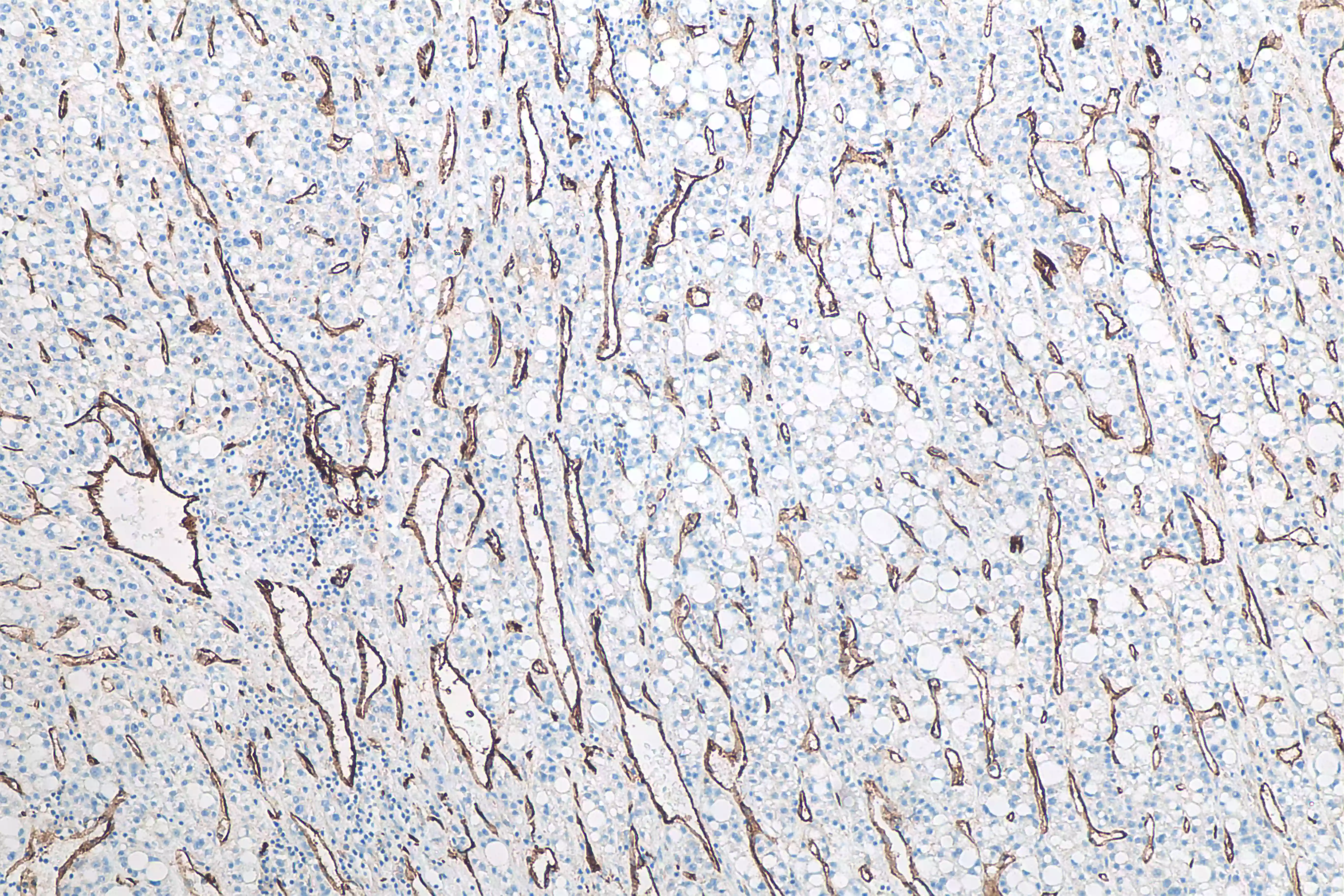 CD31 antibody (66065-2-Ig) | Proteintech