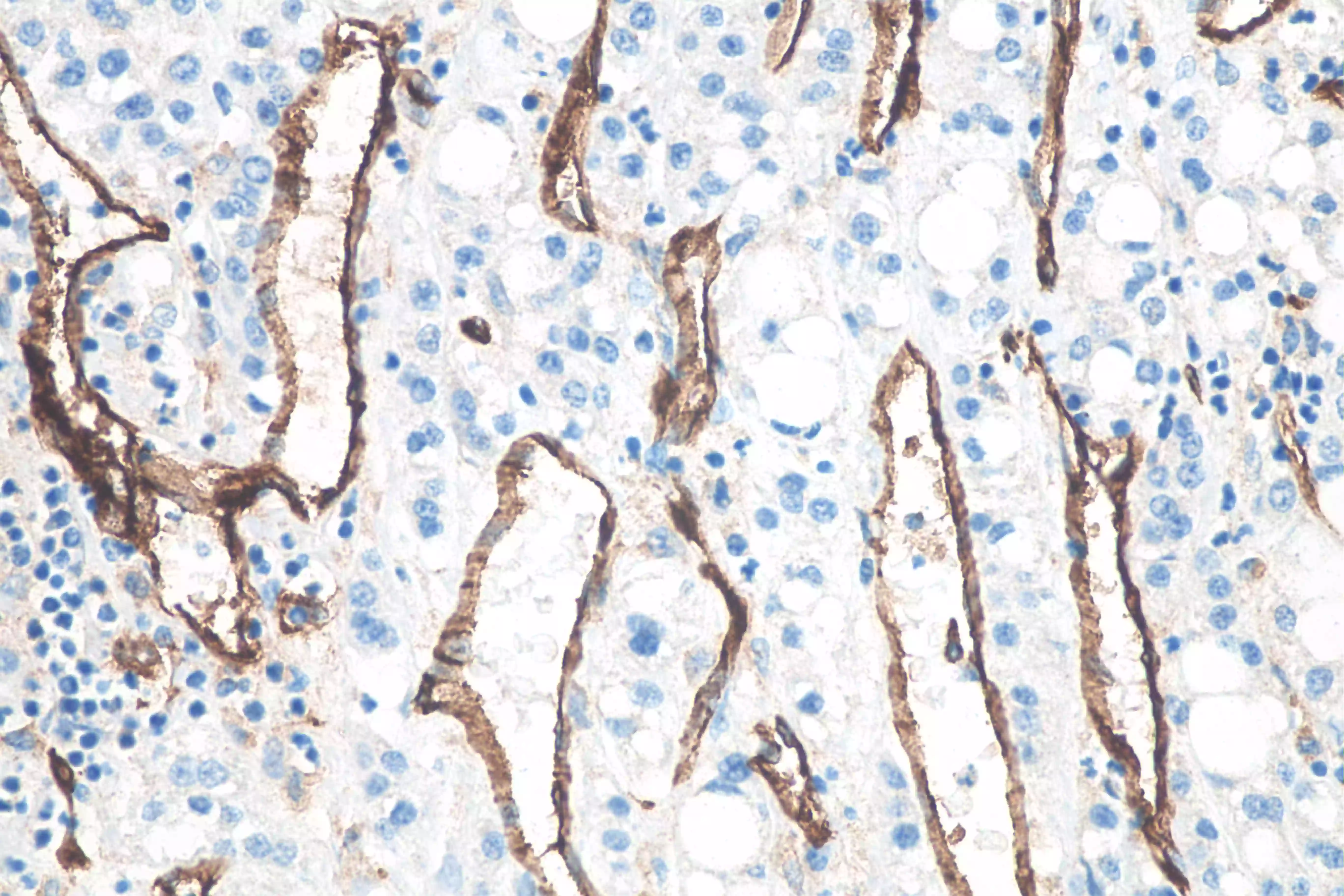 CD31 antibody (66065-2-Ig) | Proteintech