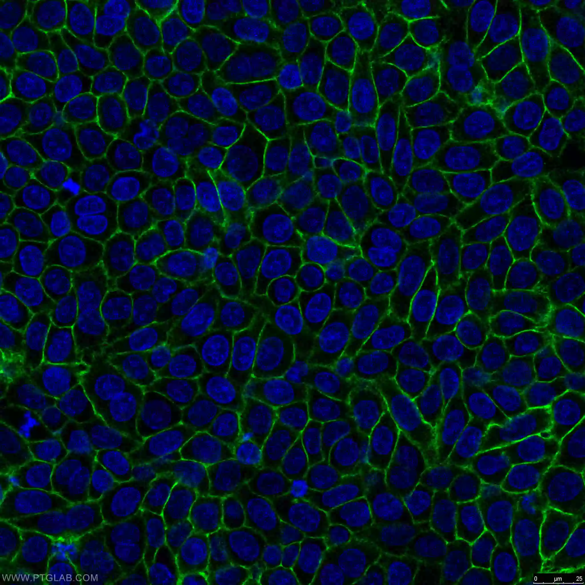 Immunofluorescent analysis of fixed HeLa cells using proteintech's Cd44 antibody 15675-1-AP
