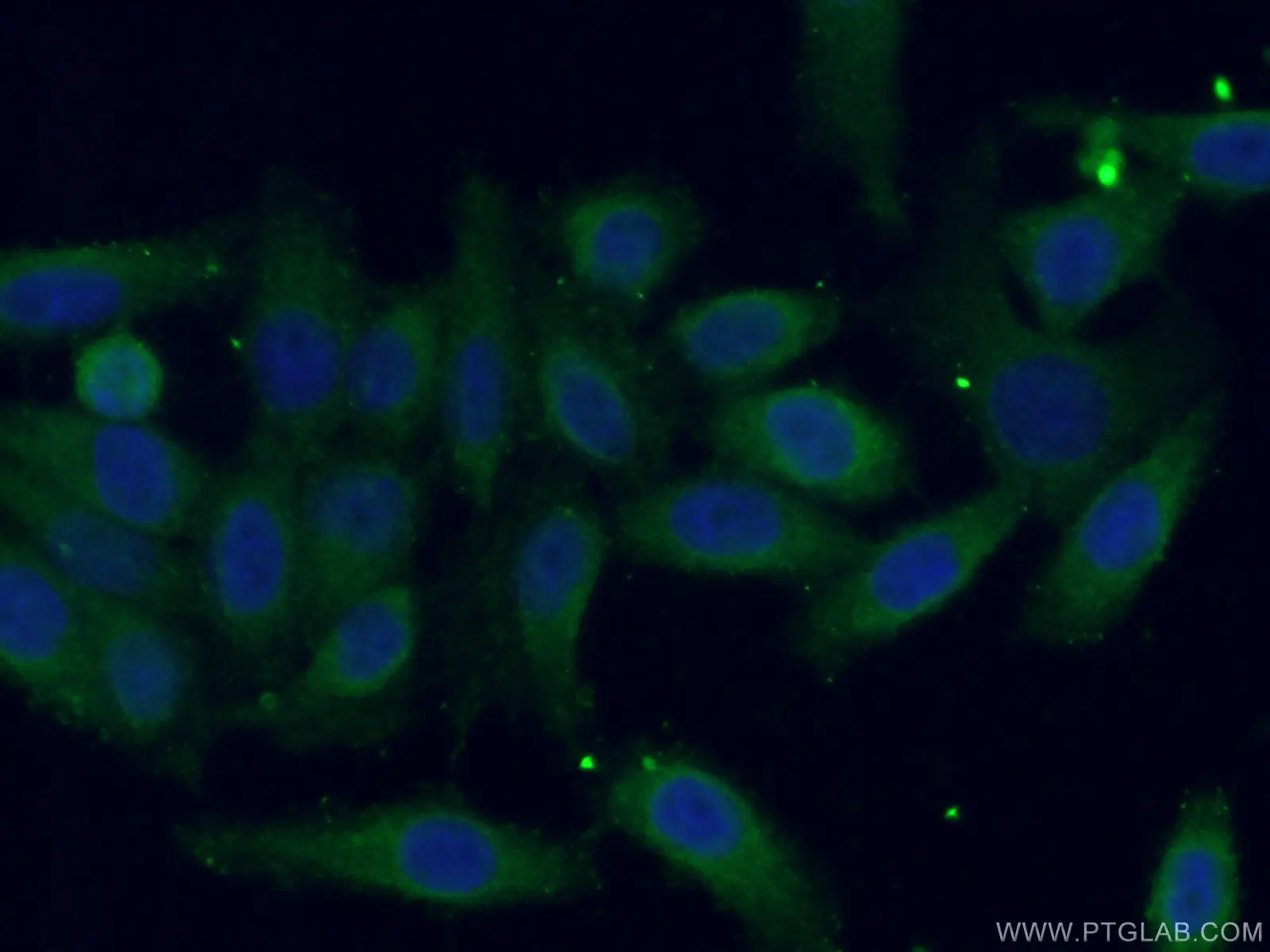 CDC123/C10orf7 antibody (28178-1-AP) | Proteintech